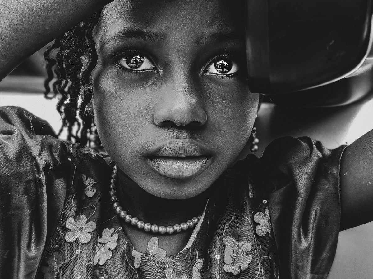 Where Does It&nbsp;Hurt?